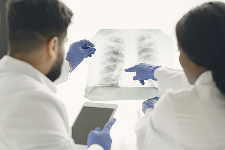 Escolha da terapia-alvo no combate ao câncer de pulmão.