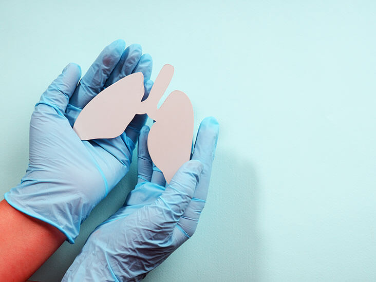 Avanços no uso da biópsia líquida para monitorar a resposta ao tratamento