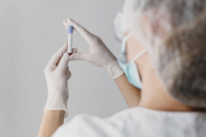 Biópsia líquida no câncer de pulmão: uma nova era no acompanhamento de pacientes