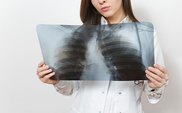 Como as nanopartículas estão revolucionando a luta contra o câncer de pulmão