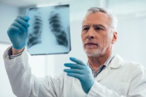 Médico maduro e confiante em pé com uma radiografia de tórax e olhando para ele