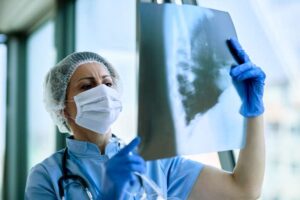radiologista feminina analisando radiografia de torax de um paciente na clinica medica durante epidemia de coronavirus