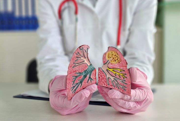 doutor mostrando um pulmão ilustrativo