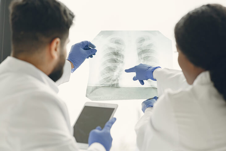 médicos analisando raio x do pulmão