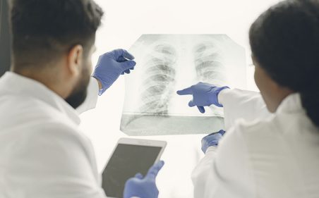 Escolha da terapia-alvo no combate ao câncer de pulmão.