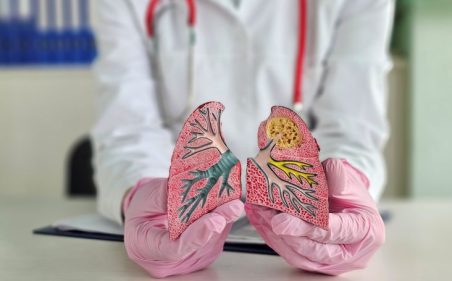 doutor mostrando um pulmão ilustrativo