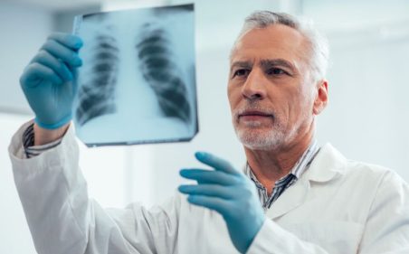Médico maduro e confiante em pé com uma radiografia de tórax e olhando para ele
