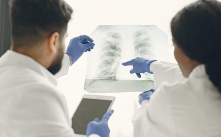 médicos analisando raio x do pulmão