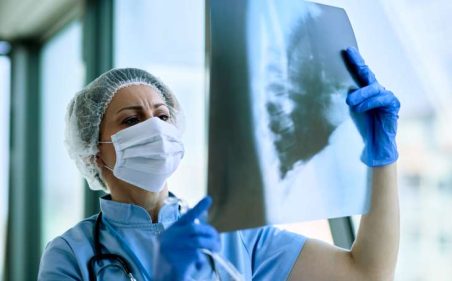 radiologista feminina analisando radiografia de torax de um paciente na clinica medica durante epidemia de coronavirus